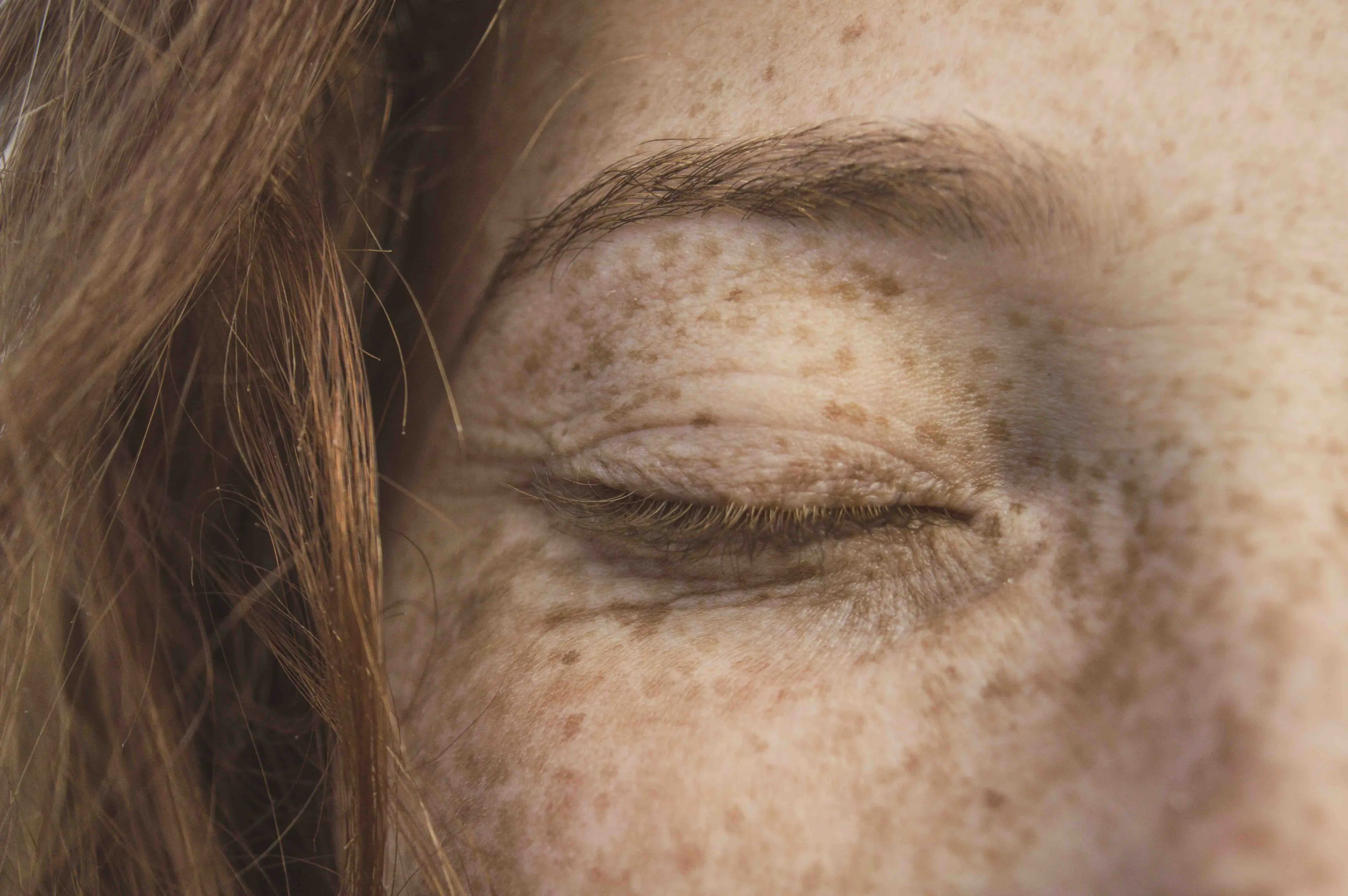 Close-up of a person's face showing natural skin texture and freckles